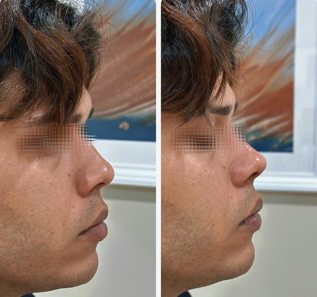 Resultados Duradouros