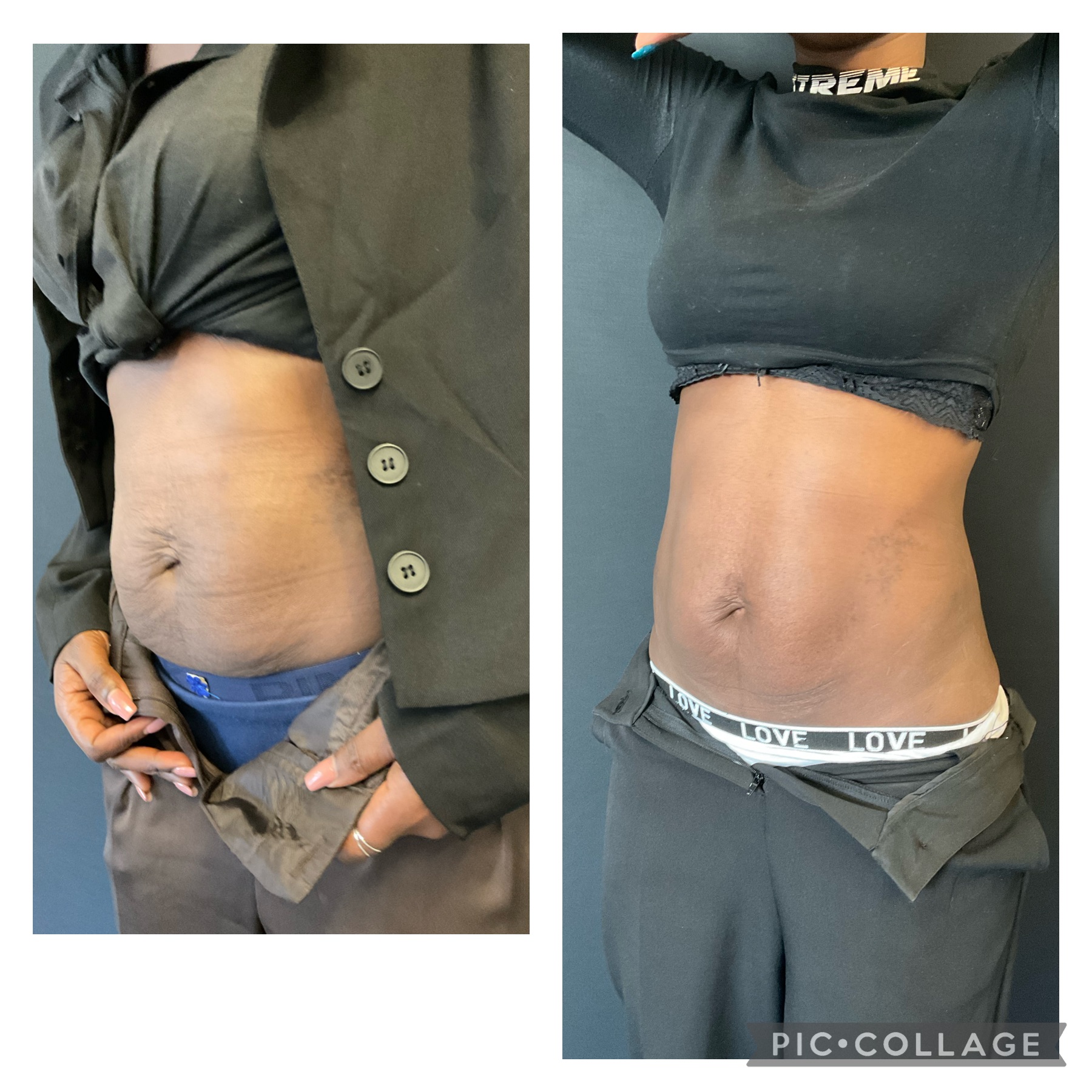 Resultado Estético Premium