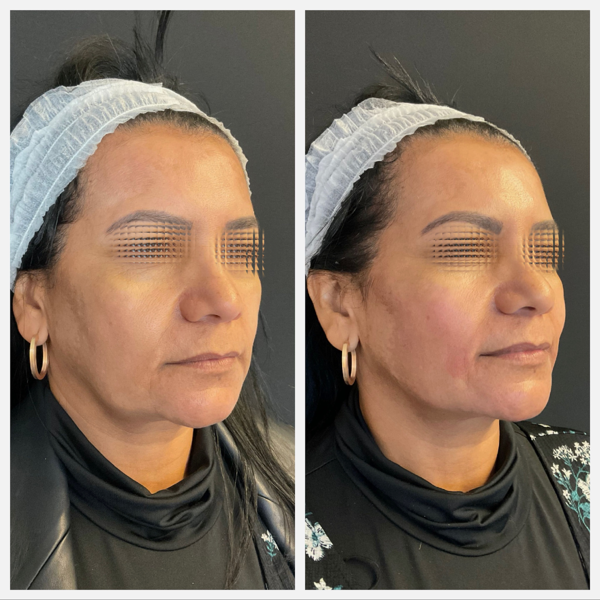 Transformação Natural