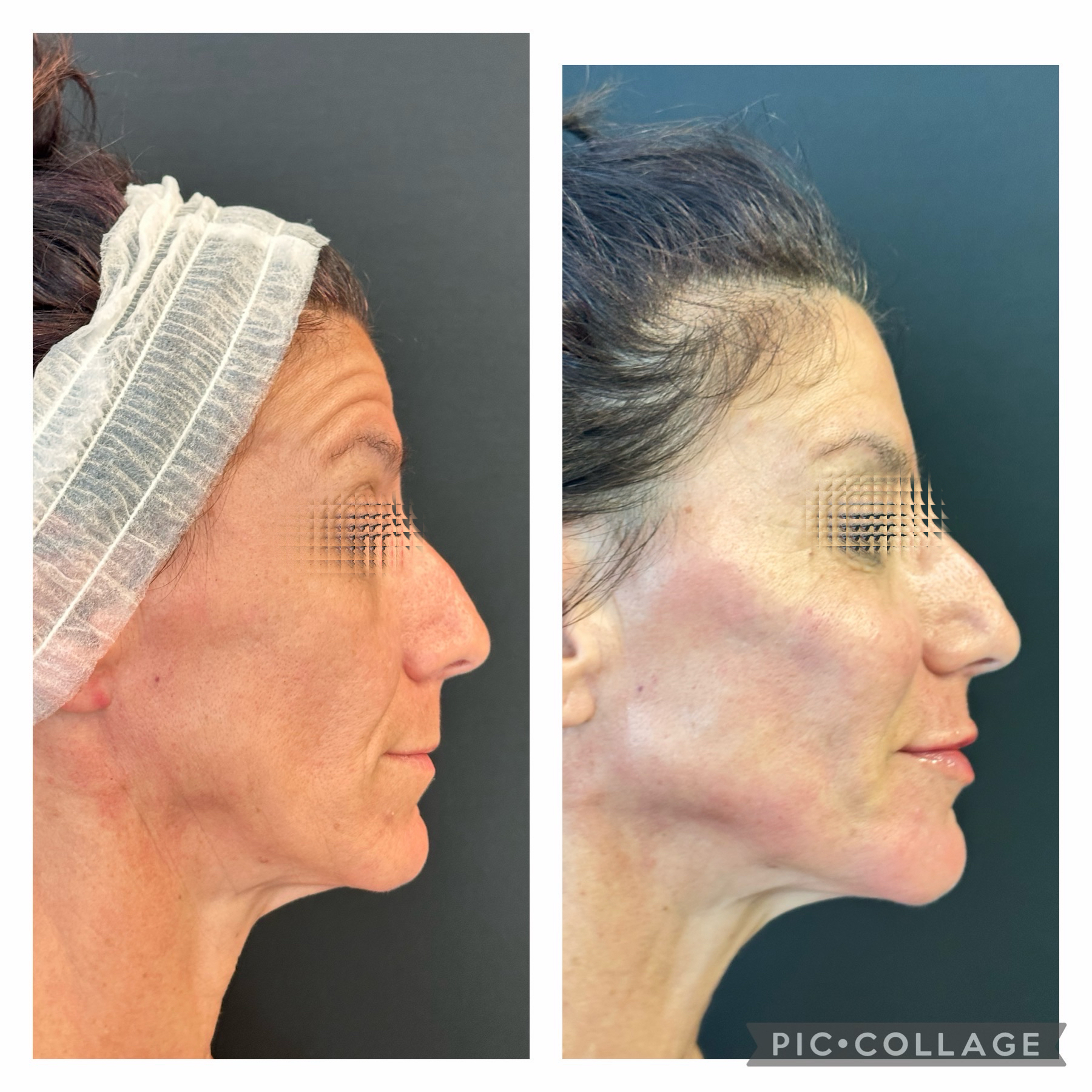 Tratamento Personalizado