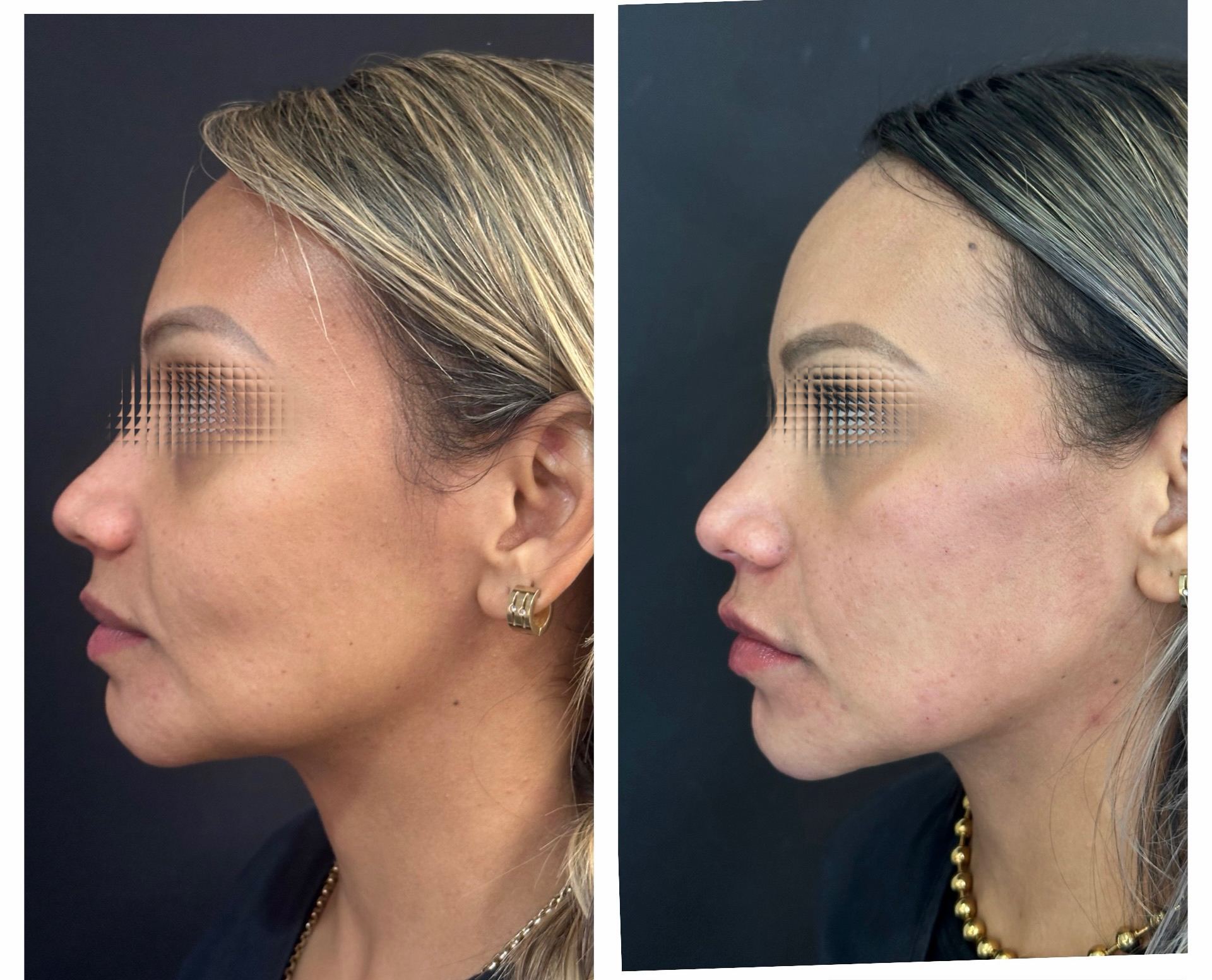 Transformação Completa